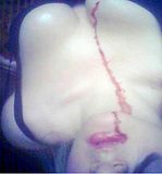 bleeding.bmp image by penguinfromhell
